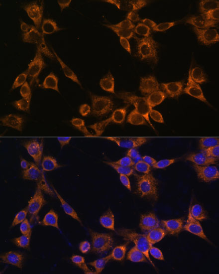 RAMP1 antibody