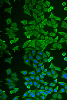 DDAH2 antibody