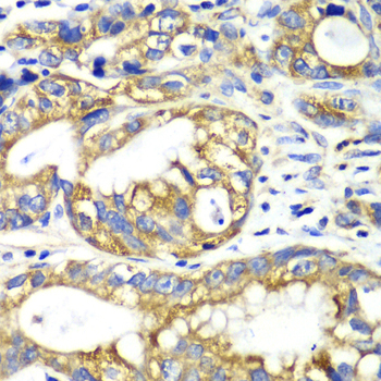 AK2 antibody