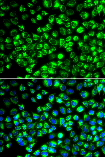 ATP6AP2 antibody