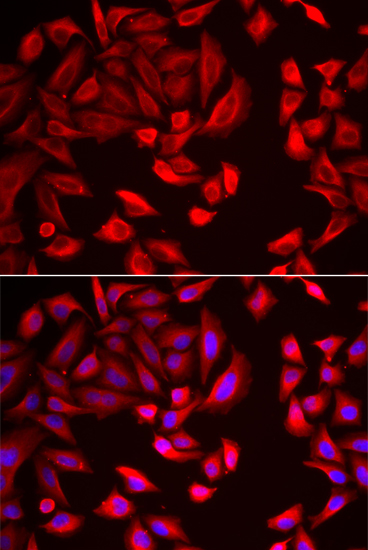 CCT2 antibody