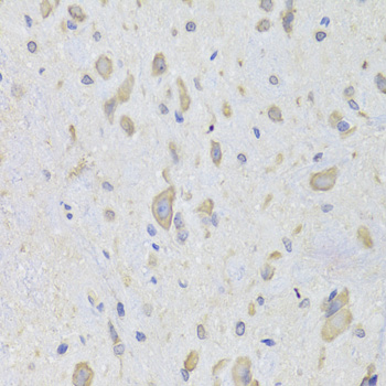 EEF1B2 antibody