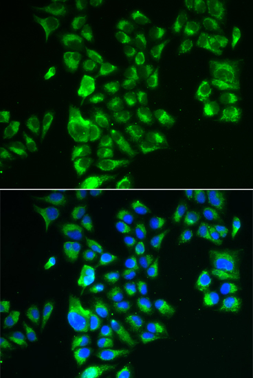 GLUD2 antibody