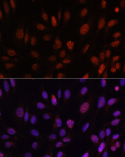 HOXB1 antibody