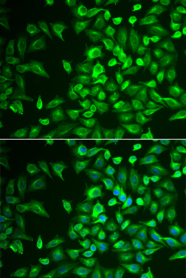 LRAT antibody