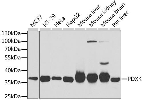 PDXK antibody