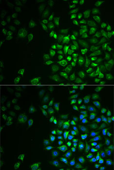 POLG2 antibody