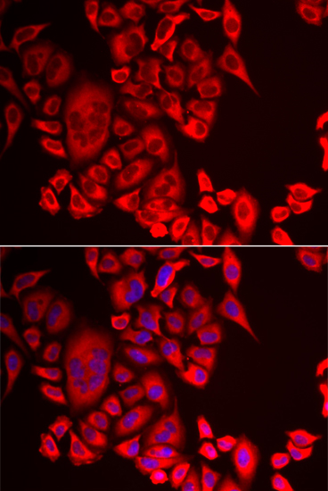 QPCT antibody