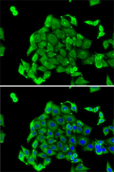 RPS14 antibody