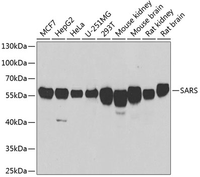 SARS antibody