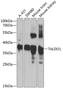 TALDO1 antibody