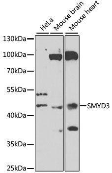 SMYD3 antibody