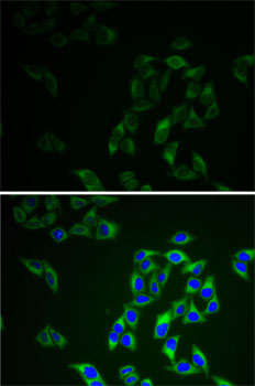 AK1 Antibody