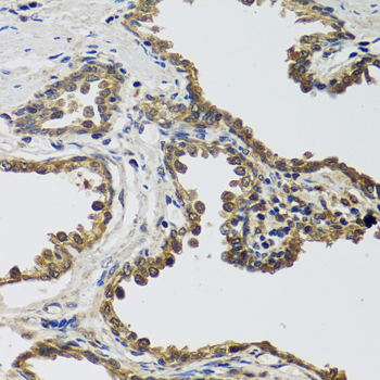 IL25 Polyclonal Antibody