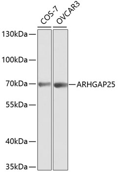 ARHGAP25 Antibody