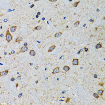 CDK1 Antibody