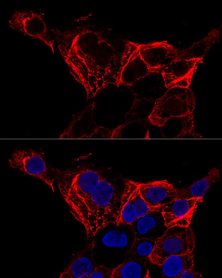 KRT20 Antibody