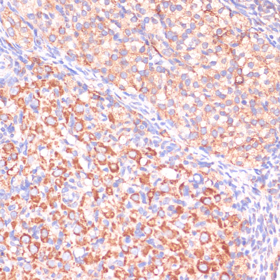 VHL Antibody