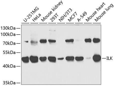 ILK Antibody