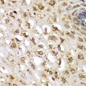 SGK1 Antibody