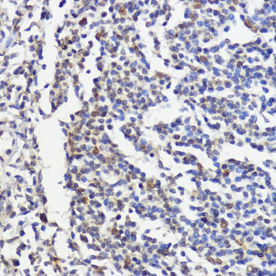 pan-AKT antibody