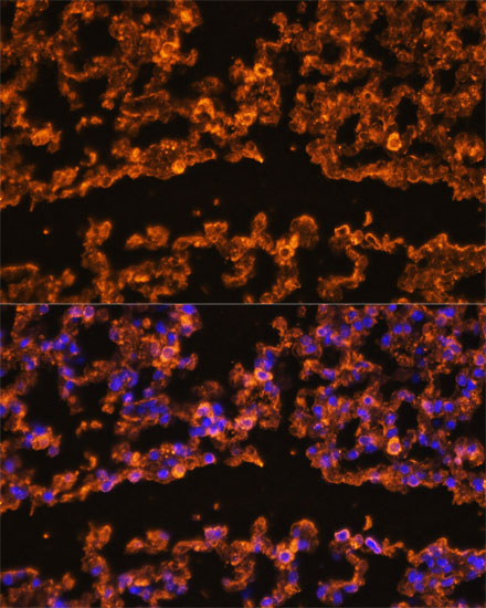 IL1B Antibody