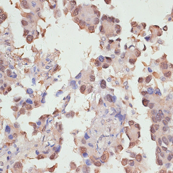 YAP1 Rabbit Polyclonal Antibody