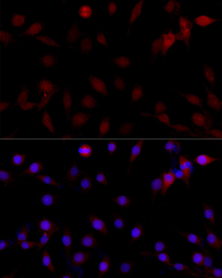 Caspase3 Polyclonal Antibody