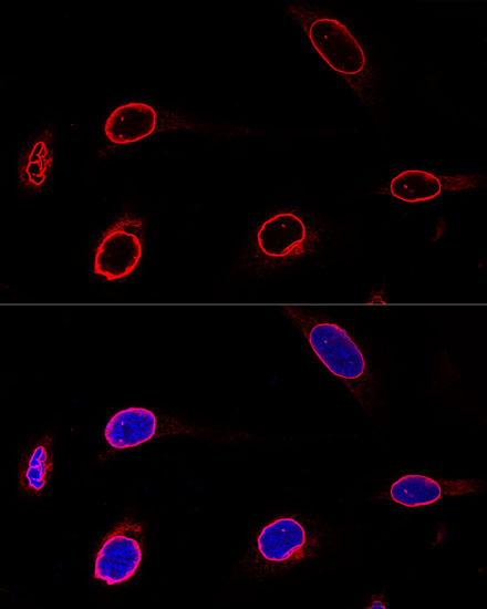 EMD Antibody