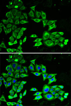 PRKAA1 Antibody