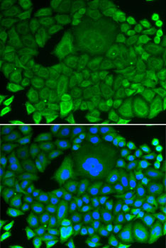 ARHGDIA Antibody