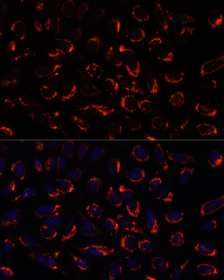 SHMT2 Antibody