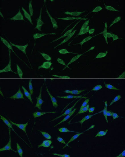 ARHGAP25 Antibody