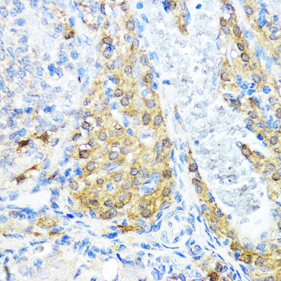 NOD1 Antibody