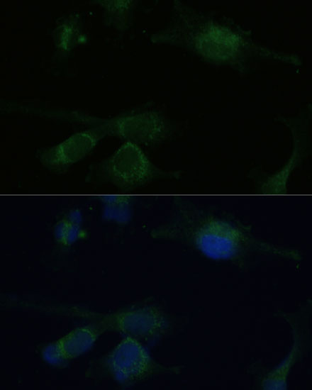 VHL Antibody