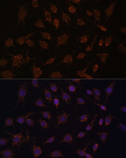 ACAT1 Antibody