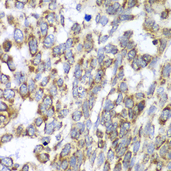 DLST Polyclonal Antibody