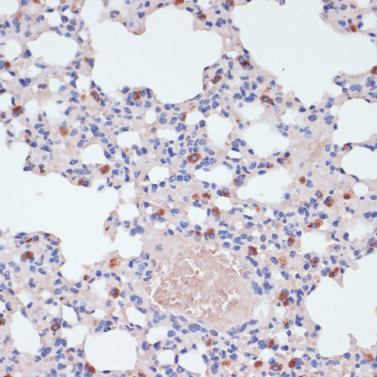 LYZ Polyclonal Antibody