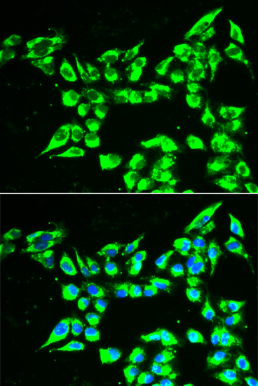 KLK10 antibody