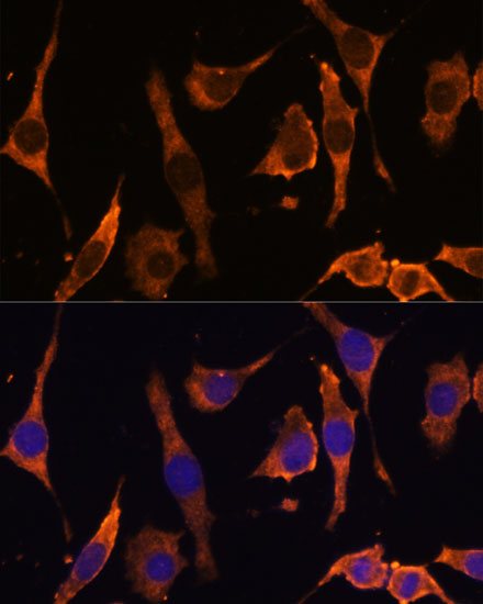 RPL36AL Polyclonal Antibody