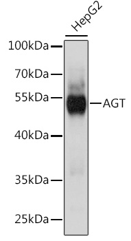 AGT antibody