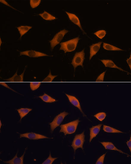 ATXN2 Polyclonal Antibody