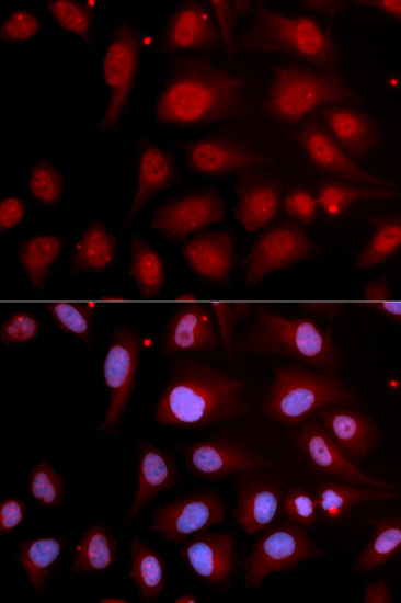 POLB Antibody