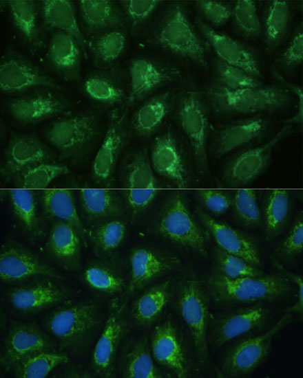 FXN Antibody