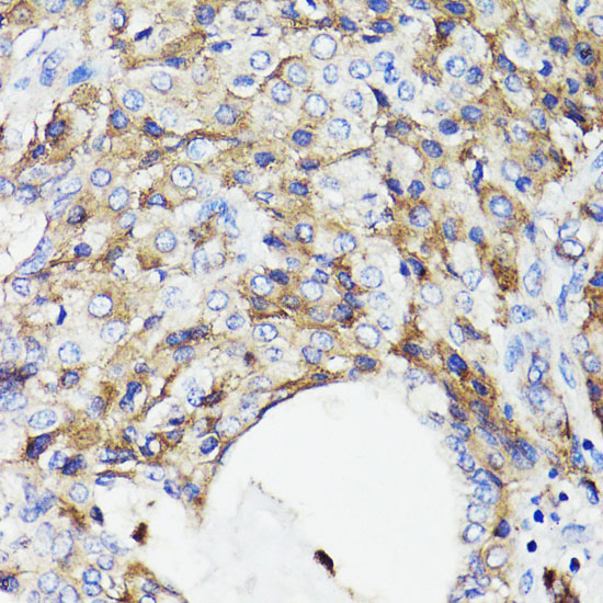 CD59 Antibody