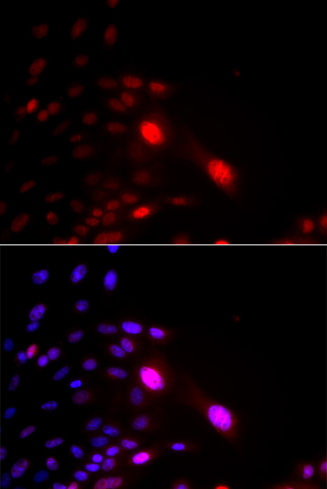 DDB2 Antibody