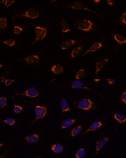 PDHA1 Antibody