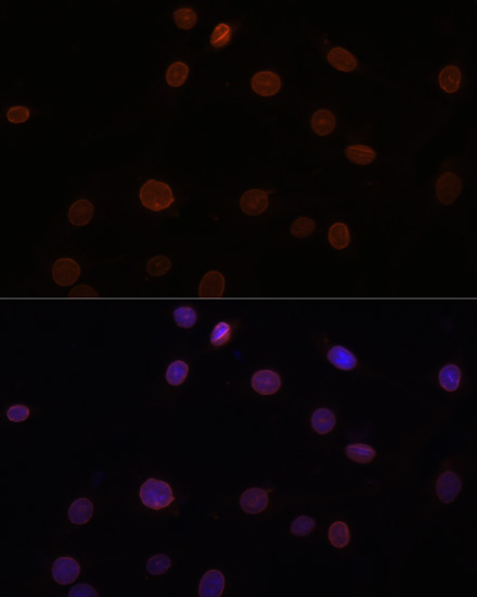 LMNB1 Antibody