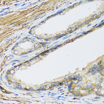 CSH1 antibody