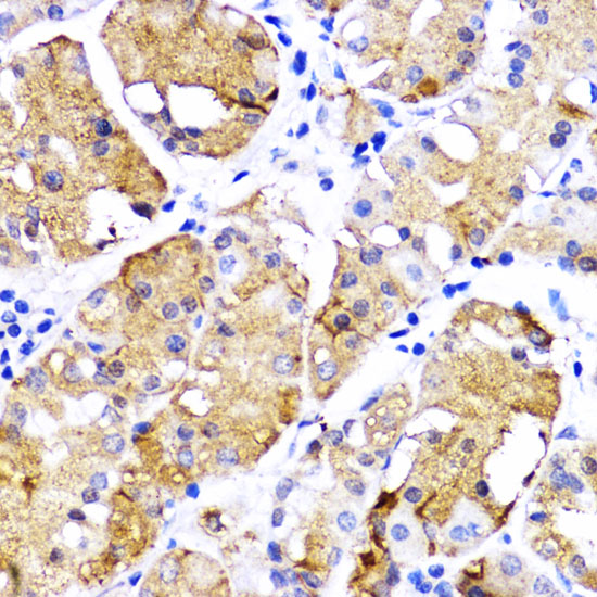 BMPR1B Antibody